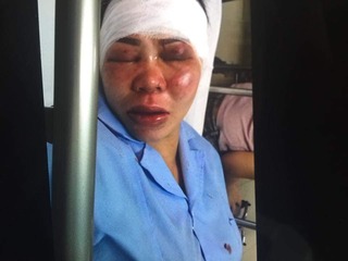 Khởi tố, bắt giam người chồng đánh đâp và cắt gân vợ ở Quảng Ninh
