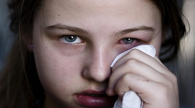 Một số người tự chữa đau mắt đỏ tại nhà nhưng không đúng cách khiến bệnh biến chứng nguy hiểm (Ảnh minh hoạ: Internet)
