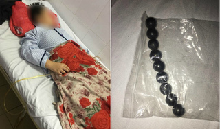 Bé trai 10 tuổi suýt mất mạng vì nhóm bạn ép nuốt 9 viên bi nam châm 