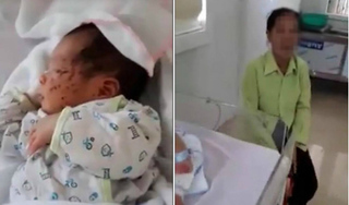 Sức khỏe bé sơ sinh bị mẹ đẻ nhét xuống nhà xí ở Thái Nguyên ra sao?