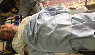 Đánh cụ ông 83 tuổi gãy hai tay vì... đi thể dục làm chó sủa không ngủ được