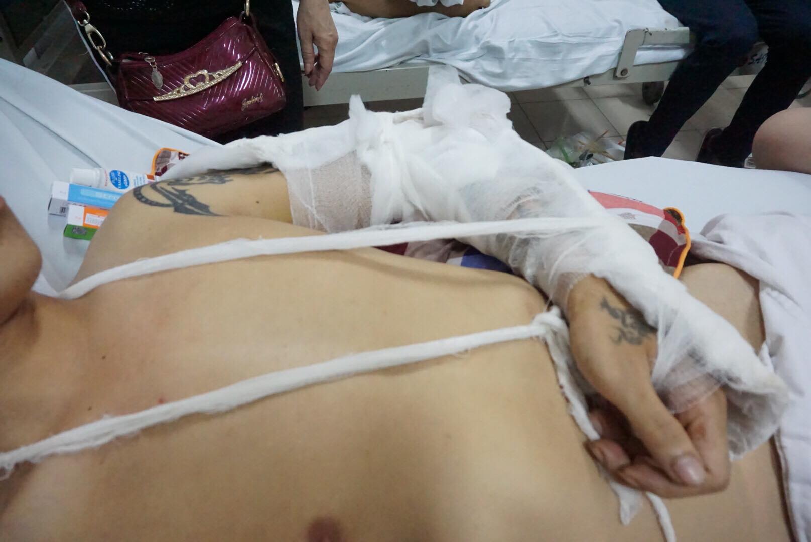 Nam thanh niên bị nhóm côn đồn truy sát ở Phú Thọ khiến tay bị thương rất nặng