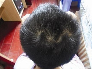 Giải mã ý nghĩa các loại xoáy tóc trên đầu con người