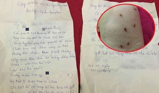 Phẫn nộ lá thư xin lỗi của giáo viên mầm non bạo hành gây ra 6 vết thương cho trẻ 11 tháng tuổi