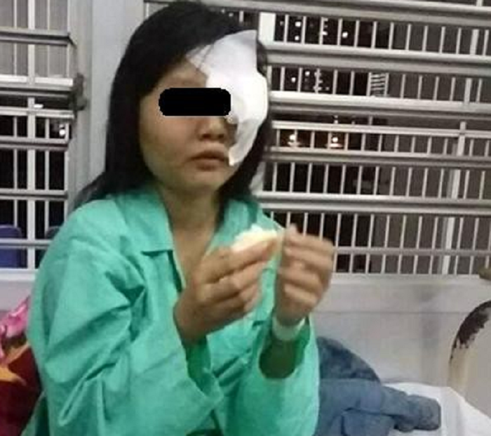 Nữ sinh bị kẻ muốn hiếp dâm đánh mù mắt ở Bình Thuận