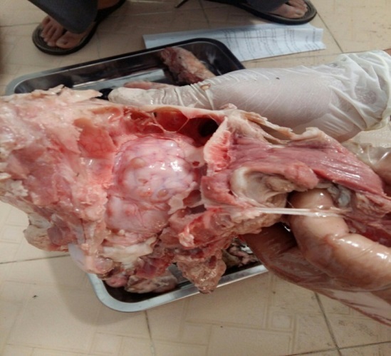 Phát hiện ổ sán dây lợn ít nhất 108 người mắc ở Bình Phước