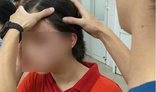 Nữ sinh lớp 9 ở Hà Nội tố bị mẹ kế đánh đập dã man lúc bố vắng nhà