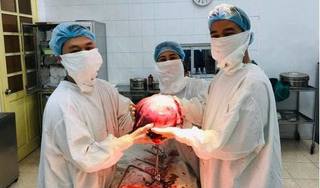 Hai giờ 'cân não' cắt khối u xơ tử cung to bằng thai nhi 9 tháng tuổi