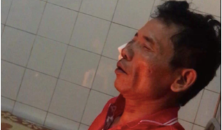 Hé lộ nguyên nhân người đàn ông bị bạn nhậu đâm tử vong ở Nam Định