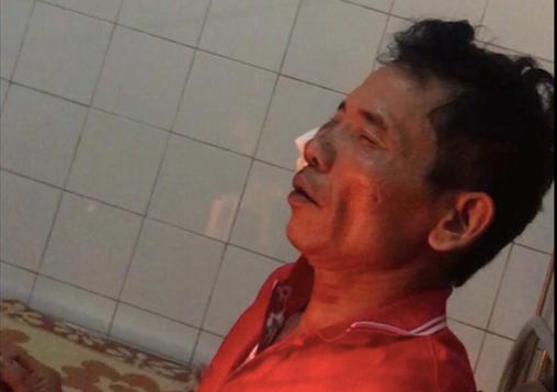 Nam Định: Nhân chứng kể lại phút người đàn ông ngã gục dưới lưỡi dao của bạn nhậu