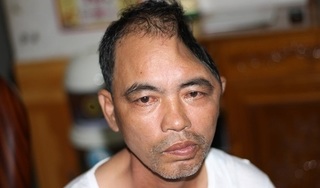 Nam Định: Người đàn ông mất một nửa hộp sọ sau vụ tai nạn giao thông kinh hoàng