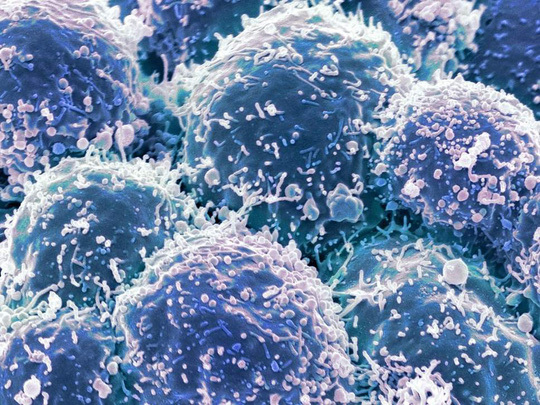 Chế tạo thành công loại virus chuyên tìm và diệt tế bào ung thư