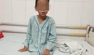 Chỉ vì một vết mụn, bé trai 9 tuổi mắc bệnh nguy hiểm 