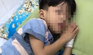 Thông tin bất ngờ về bé trai tử vong sau 1 tháng bị chó cắn ở Quảng Nam 
