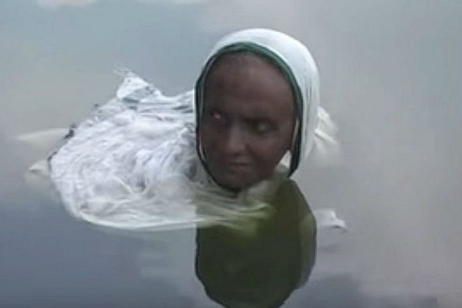 Người phụ nữ thành ‘nàng tiên cá’ suốt 20 năm vì căn bệnh bí hiểm