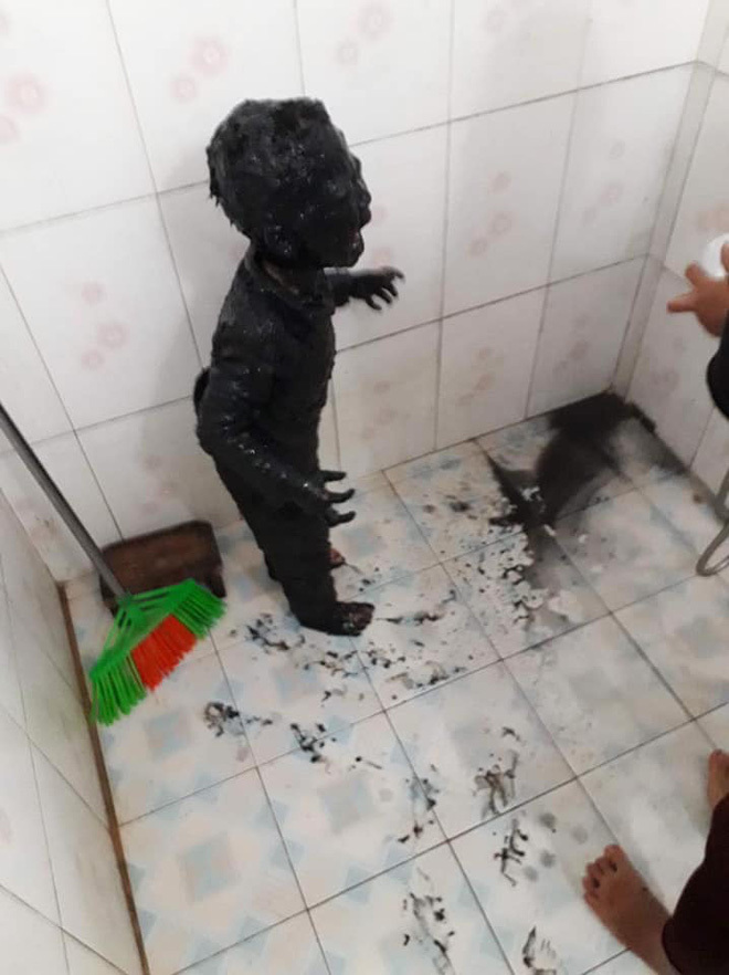 Hình ảnh bé trai bị nhuộm đen toàn thân sau sự cố đi vệ sinh