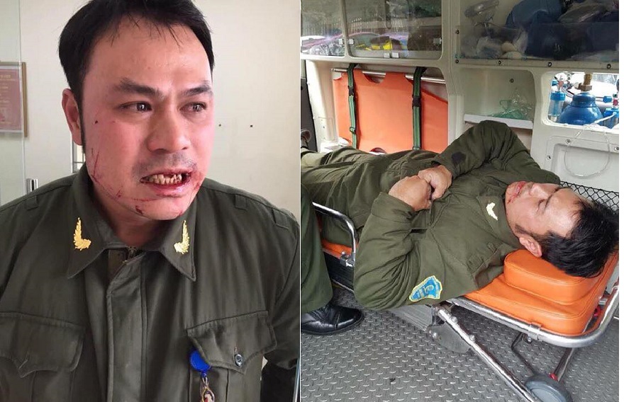Nhân viên an ninh sân bay Nội Bài bị đánh gãy 4 răng cửa