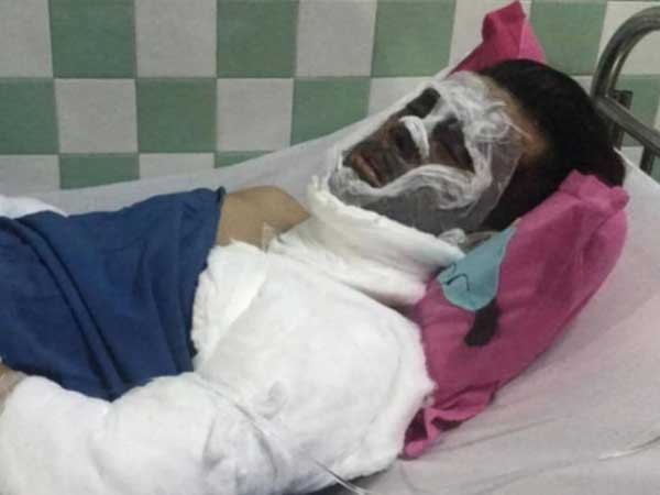 Tín hiệu tích cực cho sức khỏe của Việt kiều bị tạt a xít, cắt gân chân