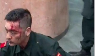 Hải Phòng: Bảo vệ quán bar bị nhóm người lạ đánh chảy máu đầu
