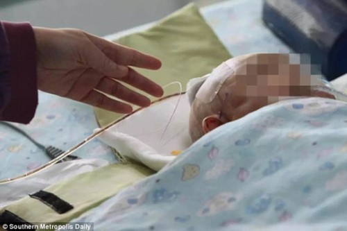 Bị bố làm rơi điện thoại trúng đầu, bé gái 2 tháng tuổi chấn thương sọ não