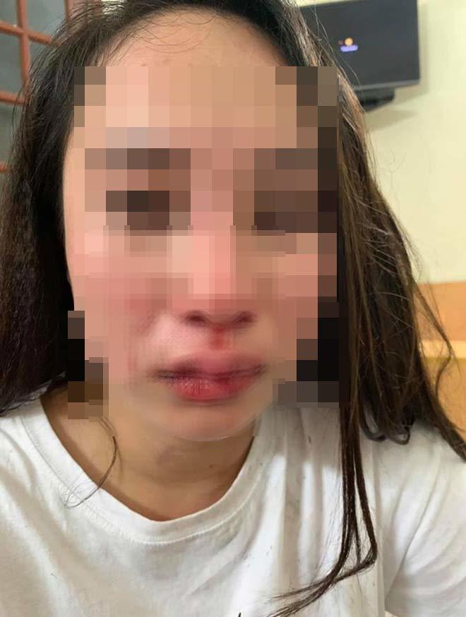 Vụ cô gái bị đánh ghen giữa phố Hà Nội: Lộ tin nhắn bằng chứng ngoại tình?
