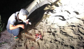 Bé trai bị gần chục con chó cắn dã man ở Hưng Yên đã tử vong