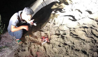 Hưng Yên: Bé trai 7 tuổi bị đàn chó cắn dã man phải nhập viện cấp cứu