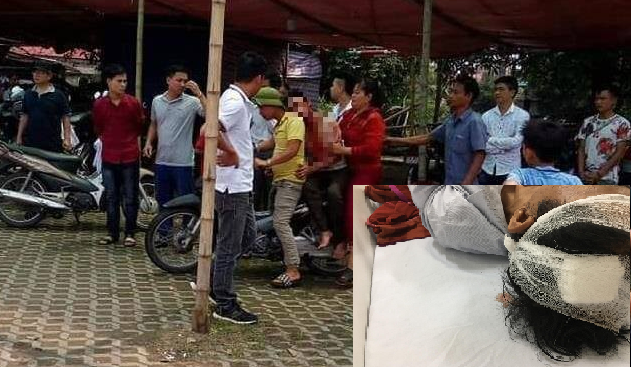 Chủ quán bị đánh dã man do mâu thuẫn 5 nghìn đồng tiền dịch vụ vệ sinh lên tiếng