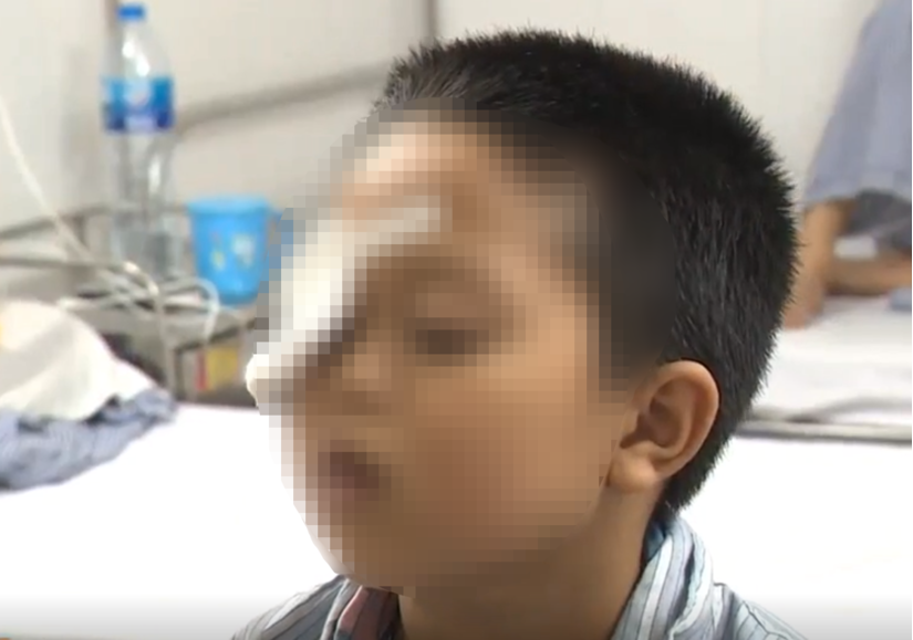 Dùng thuốc nhỏ mắt theo đơn cũ, bé 7 tuổi ở Hà Tĩnh suýt mù mắt