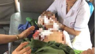 Thêm trường hợp bé trai 7 tuổi bị chó nuôi cắn tử vong ở Thái Nguyên