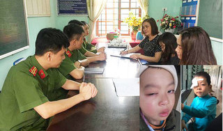 Tình tiết bất ngờ vụ cô giáo nghi đánh học sinh lớp 1 chấn thương mắt ở Lạng Sơn