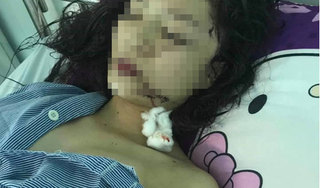 Một thiếu nữ ở Bắc Ninh bị 3 cô gái tấn công dã man trong đêm