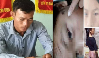 Công an viên đánh bé gái 12 tuổi thiểu năng nhập viện: 'Tôi chỉ đánh cháu để răn đe'