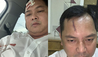 Vụ giang hồ vây xe công an ở Đồng Nai: Người bị đánh phải khâu 13 mũi nói gì?