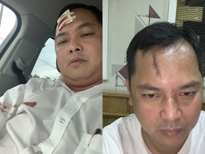 Vụ giang hồ vây xe công an ở Đồng Nai: Người bị đánh phải khâu 13 mũi nói gì?