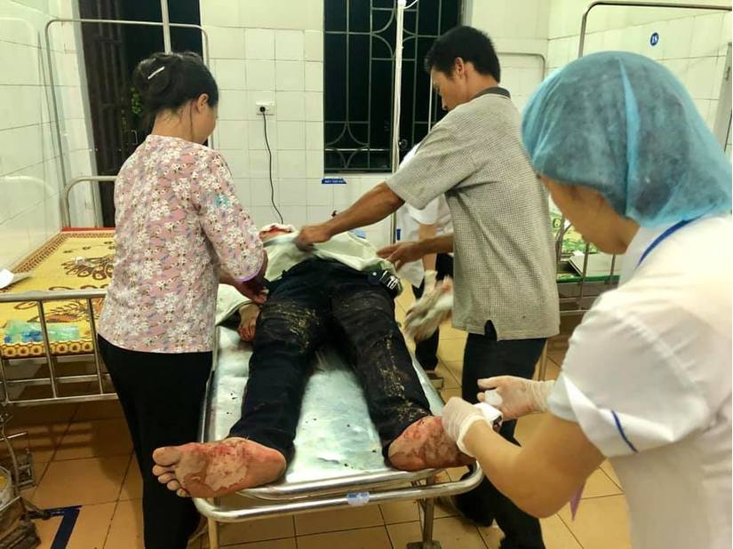 Nam Định: Mâu thuẫn cá nhân, nam thanh niên bị chém trọng thương2