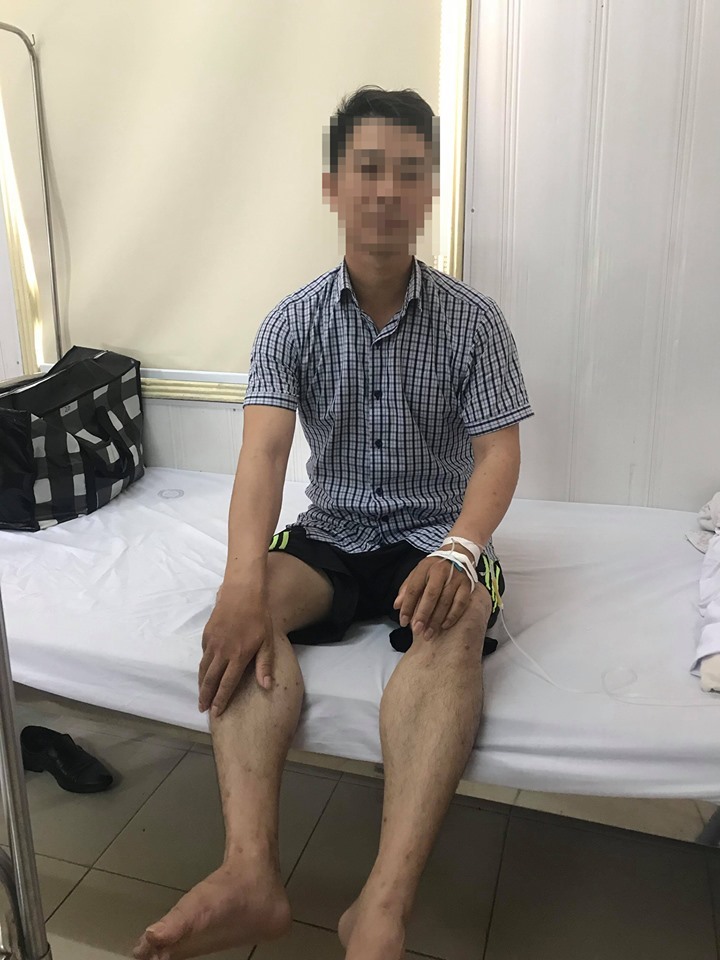 Căn bệnh lạ khiến người đàn ông Quảng Ninh bị nổi u khắp người  3