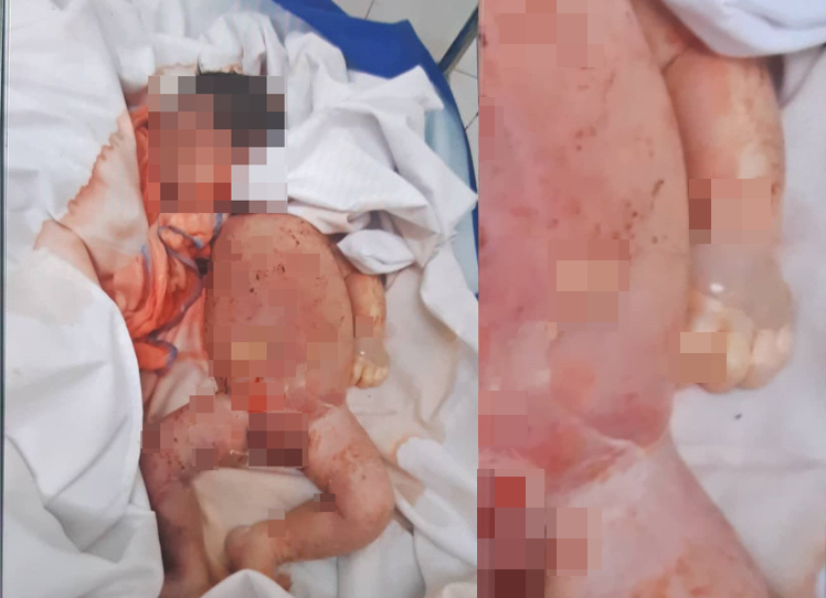Bộ Y tế yêu cầu BV huyện Đức Thọ thông tin trung thực, chính xác vụ bé sơ sinh tử vong với vết thương trên cổ 3