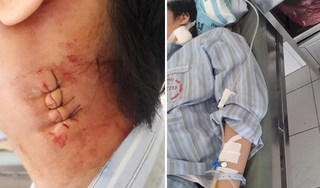 Bệnh viện Bạch Mai, Bệnh viện Nhiệt đới Trung ương bị tố chẩn đoán sai, mổ nhầm cho bé trai
