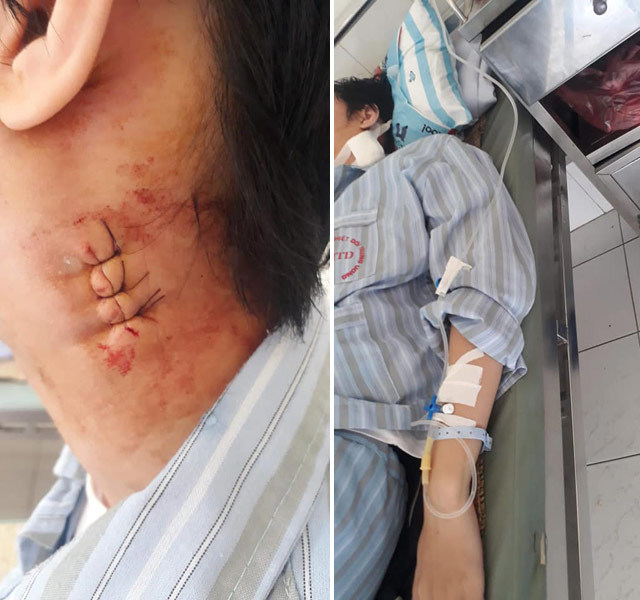 Bệnh viện Bạch Mai, Bệnh viện Nhiệt đới Trung ương bị tố chẩn đoán sai, mổ nhầm cho bé trai