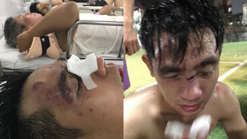 Mâu thuẫn khi đá bóng giao lưu, 1 thanh niên bị đánh nhập viện