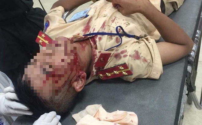 Bị dừng xe, người đàn ông cầm gạch đánh Đại úy CSGT chảy máu đầu