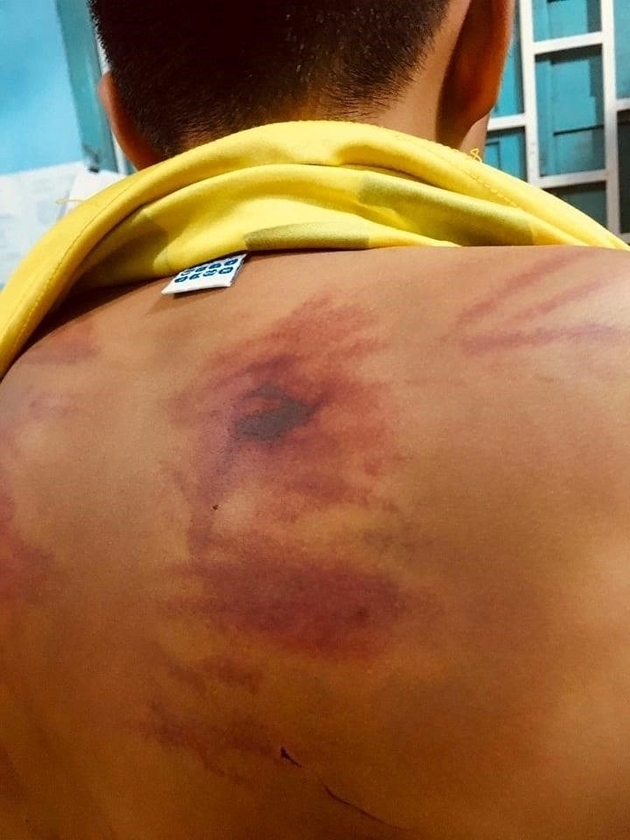 Đề nghị khởi tố sư thầy đánh bé trai 11 tuổi ở Bình Thuận2