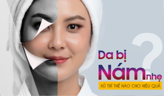 Da bị nám nhẹ nên xử trí thế nào cho hiệu quả?