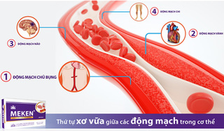 Mạch máu nào dễ bị xơ vữa động mạch nhất?