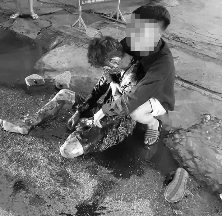 Bắc Giang: Mâu thuẫn cá nhân, nam thanh niên bị đâm trọng thương