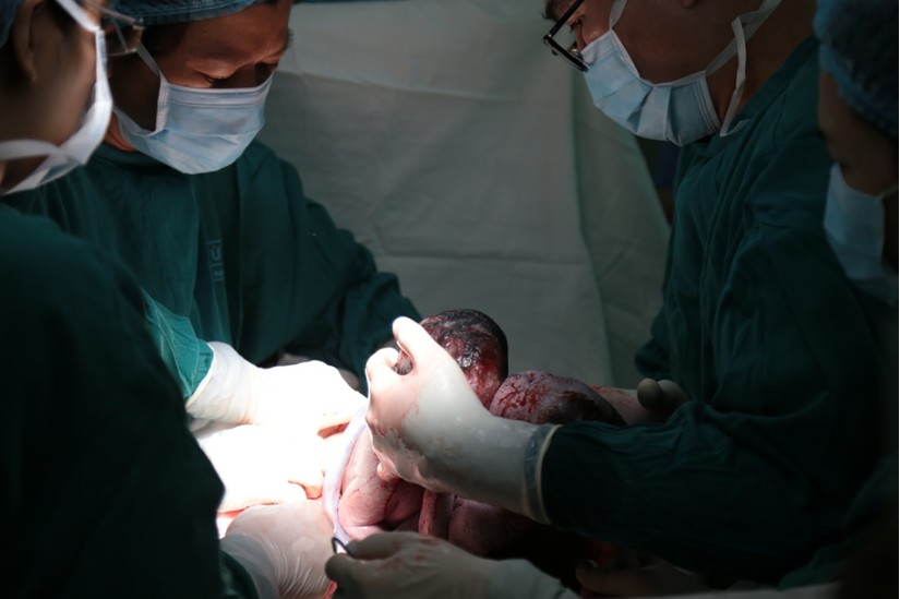 Hành trình nghẹt thở cứu hai bé song sinh dính liền nhau ở Quảng Nam 2