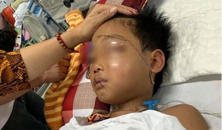Tin mới nhất về sức khỏe bé trai bị chú chém lìa tay ở Bắc Giang