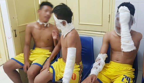 Bóng bay phát nổ bất ngờ, 3 cầu thủ Sông Lam Nghệ An bị bỏng