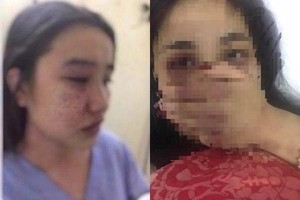 Bộ Y tế lên tiếng vụ nữ sinh thực tập tố bị bác sĩ gạ tình, đánh đập